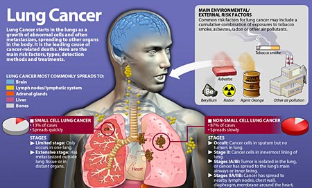 Lung Cancer - Mountain View Mirror