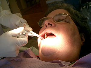 Important Details to Become a Dental Hygienist